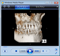 歯科用CT・動画1