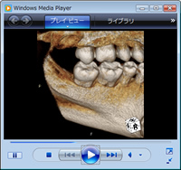 歯科用CT・動画3