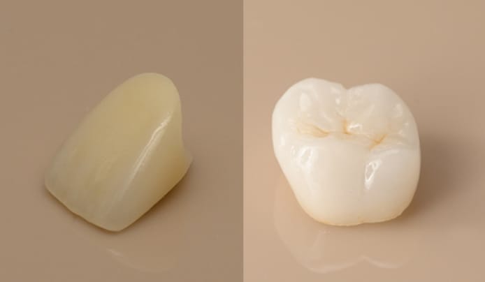 前歯や奥歯の審美セラミック治療
